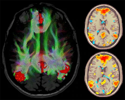 Клинические изображения МРТ аппарат GE SIGNA Premier 3T
