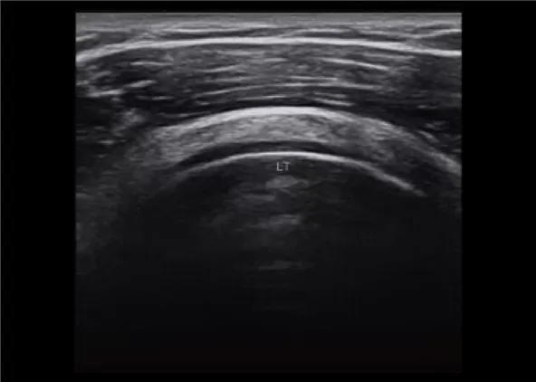 Клинические изображения УЗИ аппарат Chison CBit 4