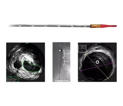 Philips Visions PV (0,035 дюйма) катетер ротационный