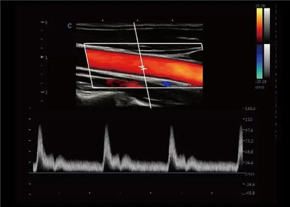 Клинические изображения УЗИ аппарат Chison CBit 9