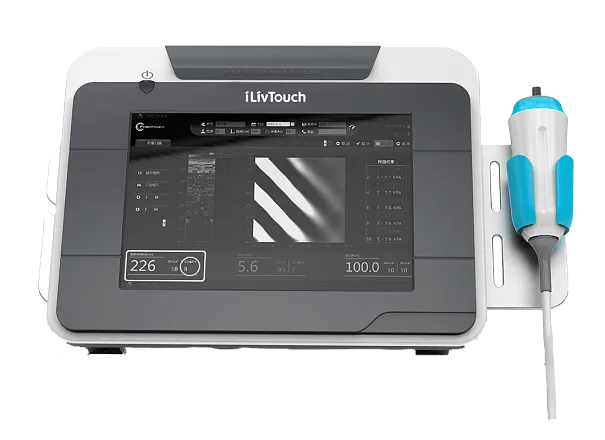 УЗИ аппарат iLivTouch FT 200 УЗИ аппарат iLivTouch FT 200