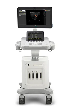 УЗИ аппарат Philips 3300 УЗИ аппарат Philips 3300