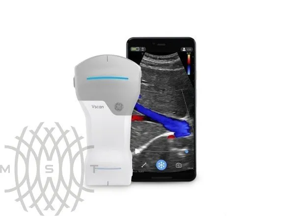 УЗИ аппарат GE HealthCare Vscan Air карманный