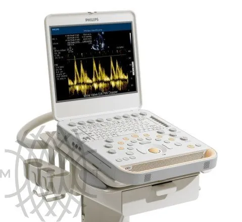 Philips CX50 ультразвуковой аппарат