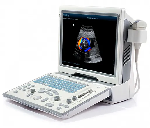 УЗИ аппарат Mindray DP-50 Color портативный УЗИ аппарат Mindray DP-50 Color портативный