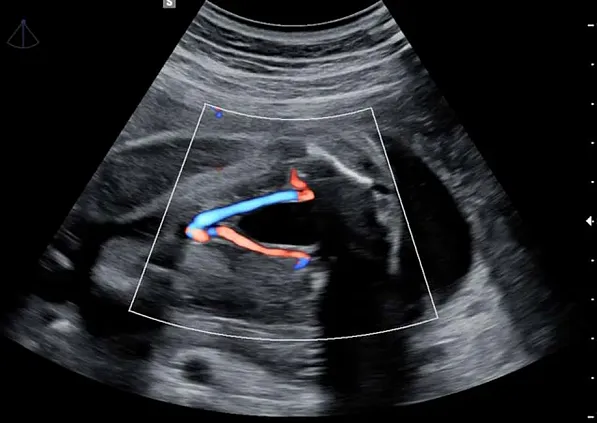 Клинические изображения УЗИ аппарат НПО СКАНЕР РУСКАН 65