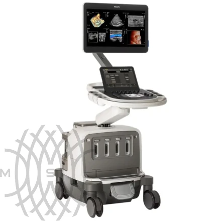 Philips EPIQ Elite ультразвуковой аппарат